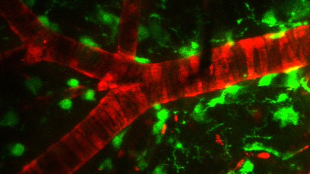 Brain vascular constriction